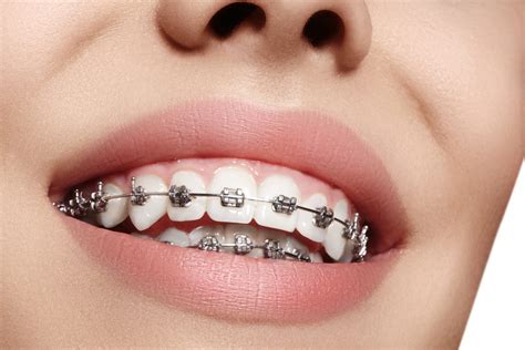 Blog King Centre Dental Dentist Va 22315