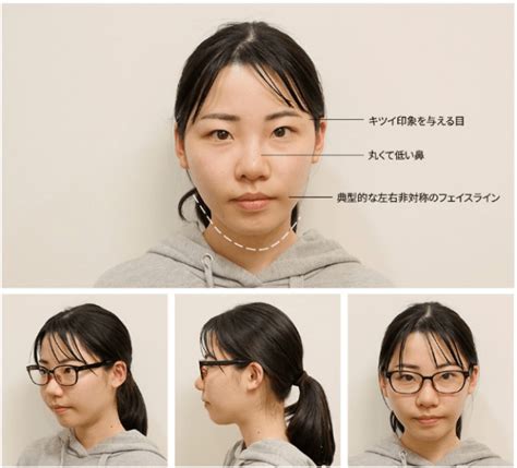 Eimi Fukada Surgery Photo【id Cosmetic Surgery】 Surprise Impact Before After From A Sober And