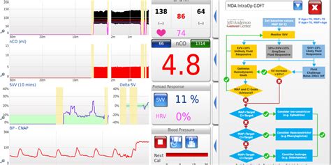 New Features Lidco Hemodynamic Monitoring For The Entire Patient