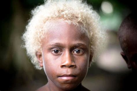 Rare Phenomenon Melanesians With Dark Skin And Blond Hair
