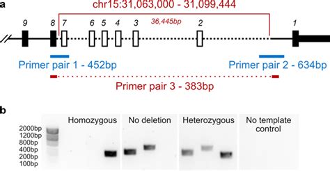 A Founder Deletion In The Trpm1 Gene Associated With Congenital Stationary Night Blindness And
