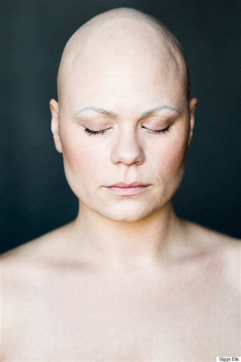 7 Stunning Portraits Of Women With Alopecia Redefine Femininity Huffpost