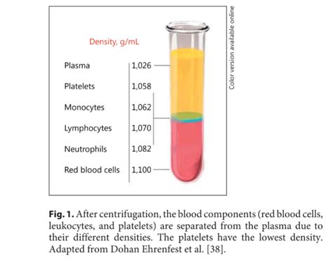 Tips For Selecting A Platelet Rich Plasma Preparation System AAOE