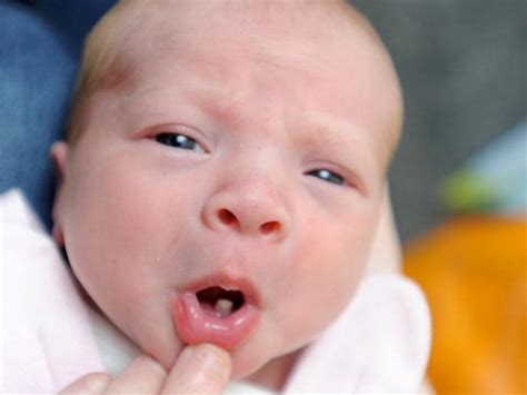 Newborn Babies Born With Teeth Teethwalls