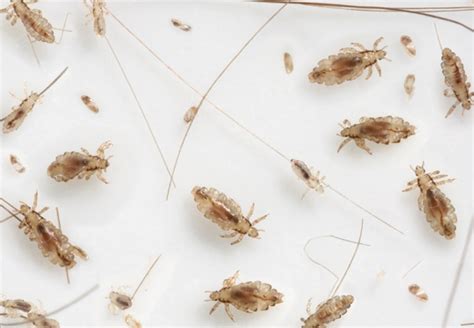 What Parents Need To Know About Head Lice Updated For 2024
