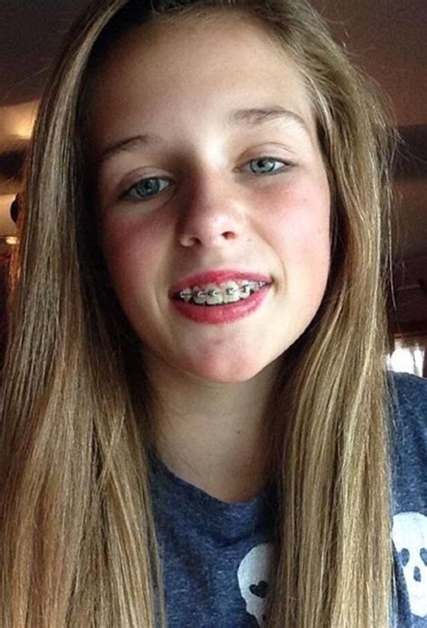 pin by marilynn wrigley on novel cute braces braces girls braces off