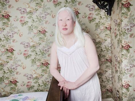 Albinism Photographs Popsugar Beauty Photo 13