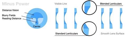 Buyers Guide Lenticular Progressive Lenses