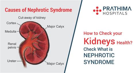 How To Check Your Kidneys Health Check What Is Nephrotic Syndrome