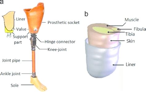 Artificial Limb Stump And Prosthetic Socket A Prosthesis Structure