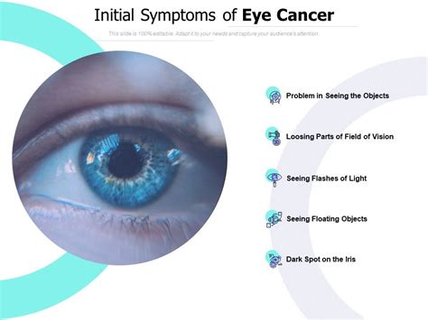 Initial Symptoms Of Eye Cancer Presentation Graphics Presentation