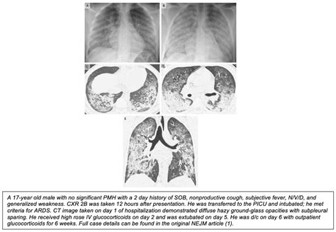 Vaping Associated Lung Injury Vali Rebel Em Emergency Medicine Blog