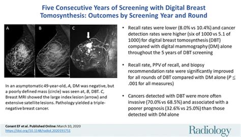 Five Consecutive Years Of Screening With Digital Breast Tomosynthesis