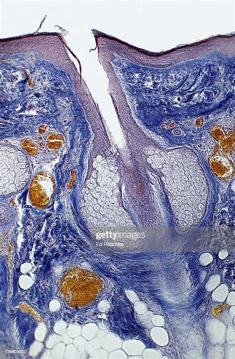 Skin Of Human Scalp Epidermis Dermis Follicle Shows Sebaceous Glands