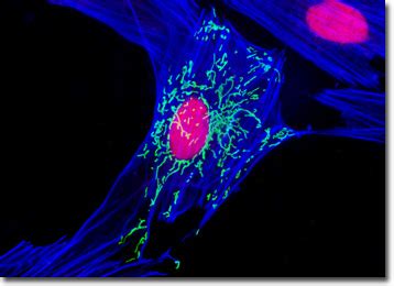 A structural polysaccharide that is found in plant cell walls. Molecular Expressions Microscopy Primer: Specialized ...