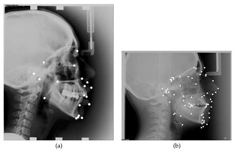Applied Sciences Free Full Text Cephalometric Landmark Detection In