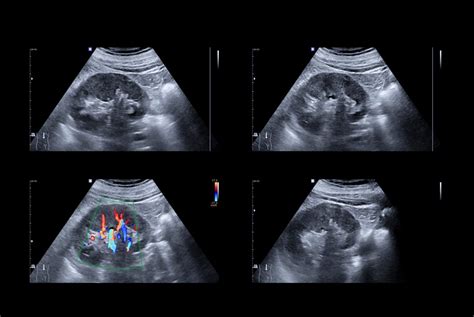 Urinary Tract Scan Rad Clinics