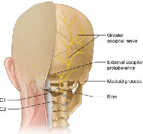 Peripheral Nerve Stimulation Spine Orthopedic Center