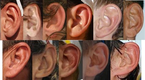 Punnetts Square Attached Earlobes The Myth