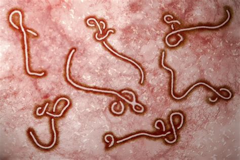 However, during outbreaks, exposure to the virus or at this time, there is not an ebola outbreak in the u.s. Ebola Env GP (Zaire, Boende-Lokolia) - The Native Antigen ...