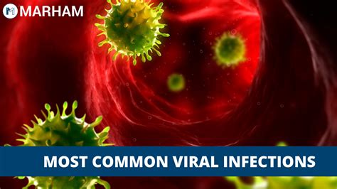 5 Most Common Kinds Of Viral Infections Marham