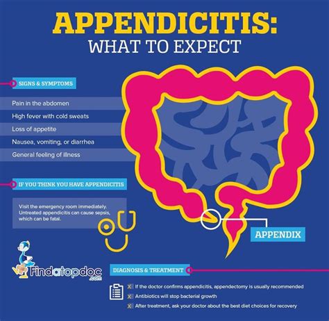 Where Does The Pain Occur When You Have Appendicitis