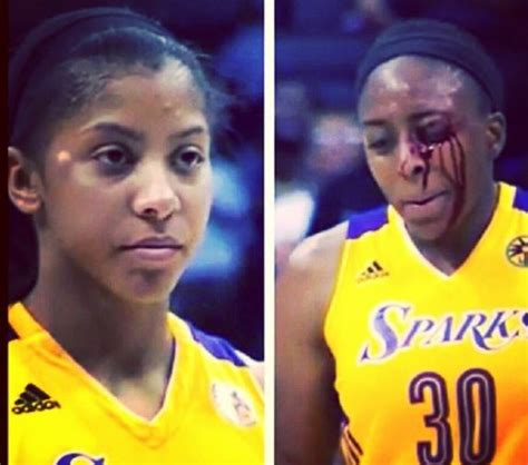 Wnba Celebration Fail Leaves Player With Busted Bloody Eye Video