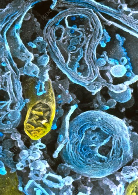Animal cells contain organelles called centrioles, responsible for animal cell division, which are not found in plant cells. Coloured SEM of lysosomes in intestinal cell - Stock Image ...