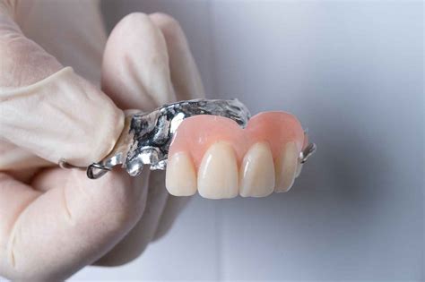 How much are partial dentures. Cobalt Chrome Partial Dentures Gold Coast Costs & Info