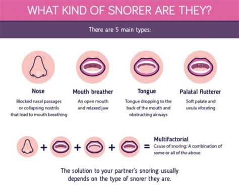 How To Stop Your Partner Snoring The Sleep Matters Club Cure For Sleep Apnea Snoring Sleep