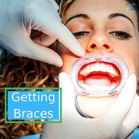 Orthodontist Putting On Braces