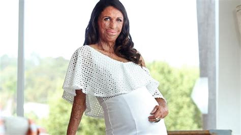 Turia Pitt On Pregnancy Ill Get A Baby From The Pain The Advertiser