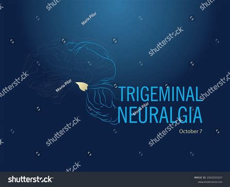International Trigeminal Neuralgia Dayoctober 7brain Silhouetted Stock