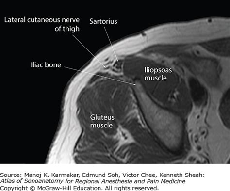 Sonoanatomy Relevant For Ultrasound Guided Lower Extremity Nerve Blocks