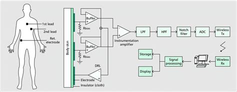 Schematic Representation Of The Ecg System Architecture And Electrode