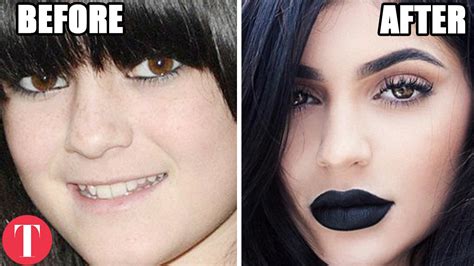 10 Famous People Who Have Admitted To Plastic Surgery Youtube