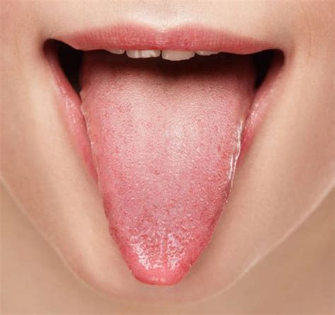 Your Tongue Can Say A Lot About Your Health Read How