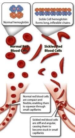 Lethal genes: Example of Dominant and Recessive lethals ...
