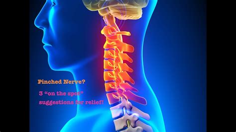 Pinched Nerve In Your Neck 3 Things To Do On The Spot Youtube