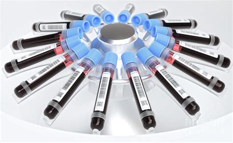 Centrifuging Blood Samples Photograph By Ktsdesignscience Photo Library