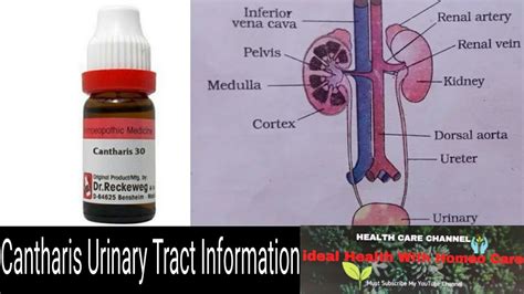 Cantharis Uses And Symptom Of Canthris In Homeopathy Urinary Tract