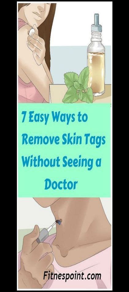 7 easy ways to remove skin tags without visiting a doctor skin tag removal skin tags home