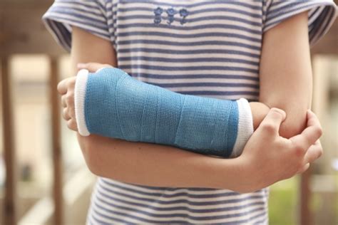 The Dos And Donts Of Cast Care