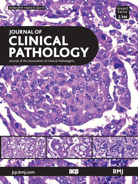 Developing a pan-cancer research autopsy programme | Journal of