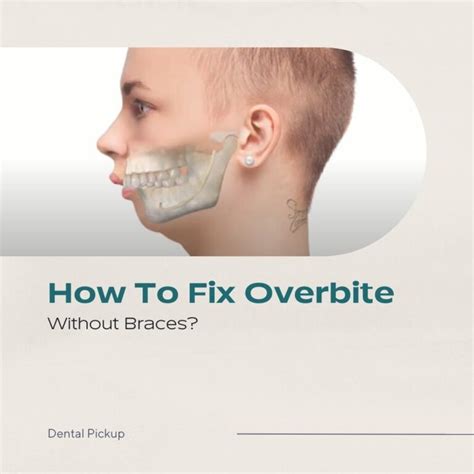 How To Fix Overbite Without Braces Dental Pickup