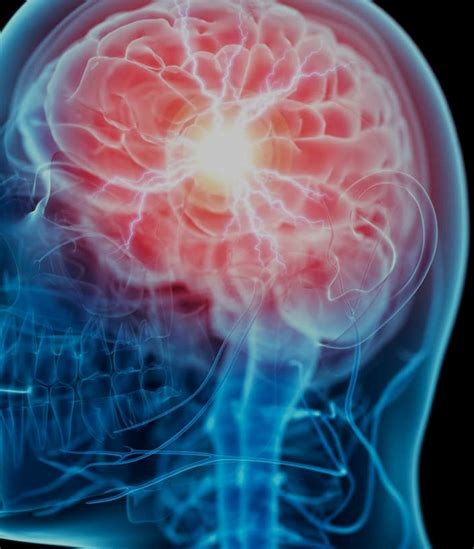 Electrode Zaps Could 'Turbo Charge' the Human Brain, Research Shows