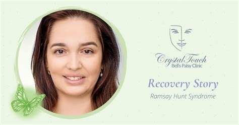 After chickenpox clears up, the virus still lives in your nerves. Gabriela: Ramsay Hunt Syndrome recovery story • Crystal ...