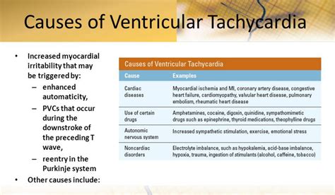 Ventricular Tachycardia What It Is Ventricular Tachycardia In Adults