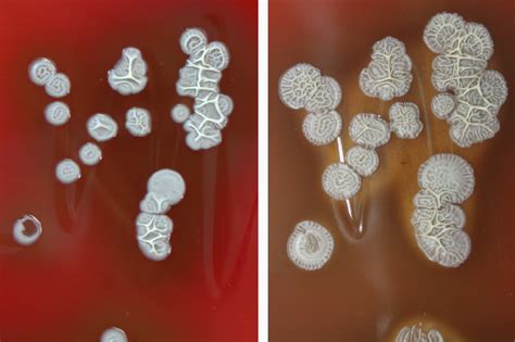 Morphology Of Colonies On Columbia Blood Agar After 24 H Left And