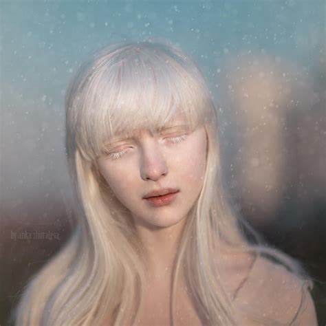 Pin By Et On Nice Albino Girl Portrait Albino Human